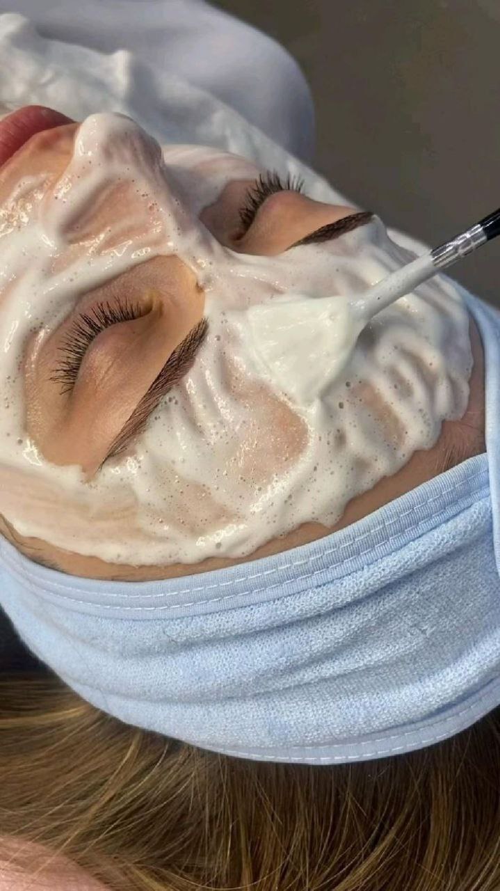 Карбокситерапия