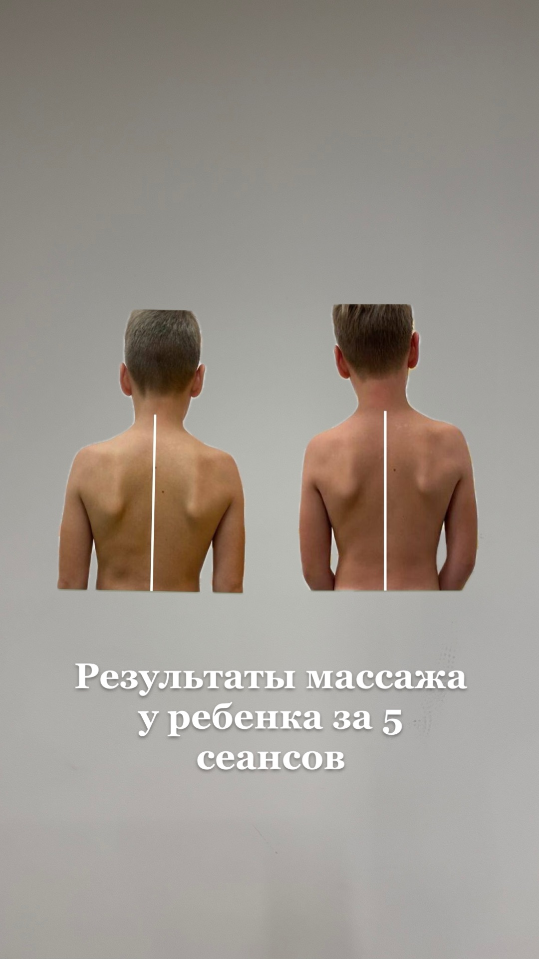 Биоэнергетический массаж детский